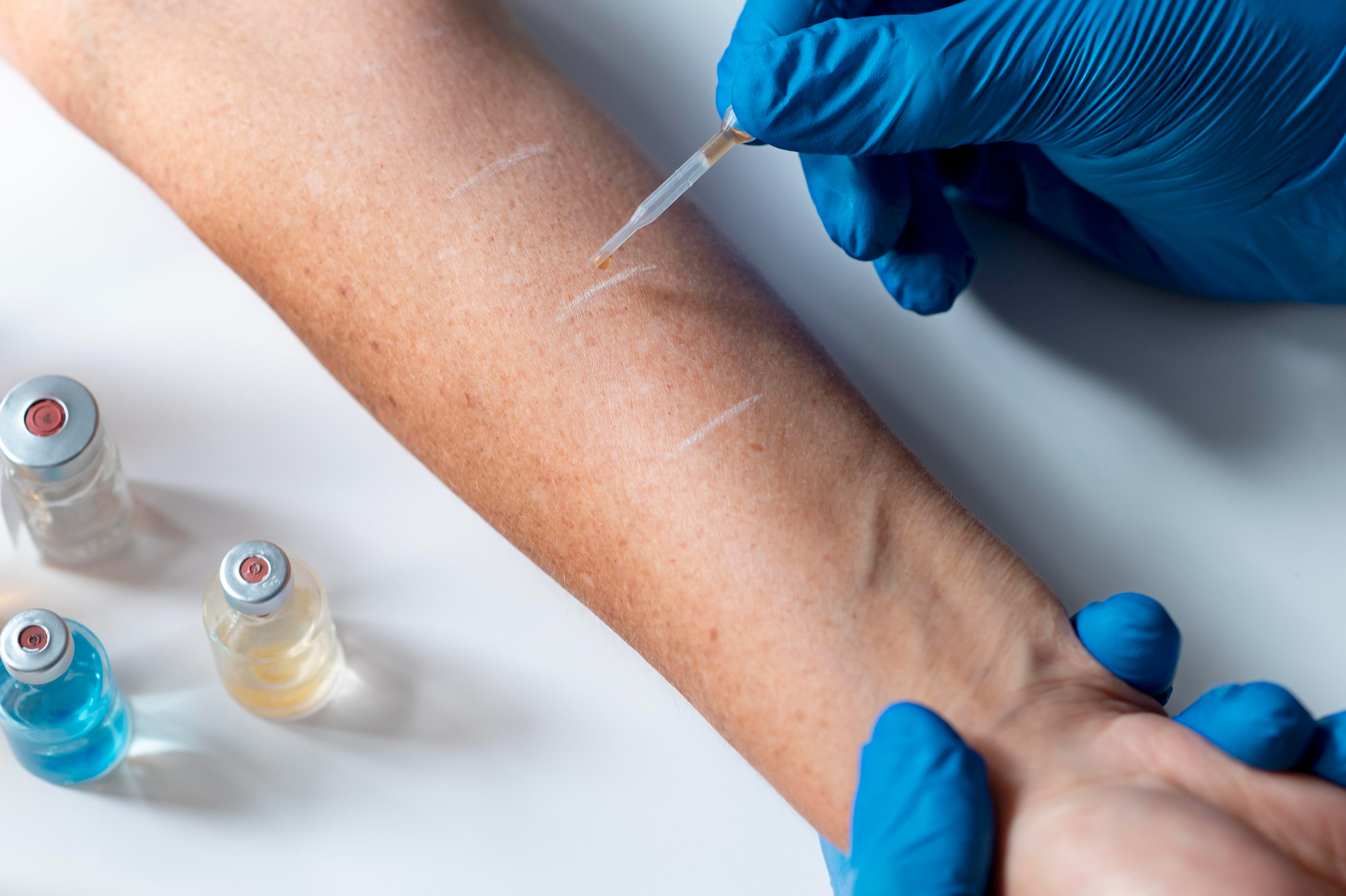 Peripheral Nerve Blocks