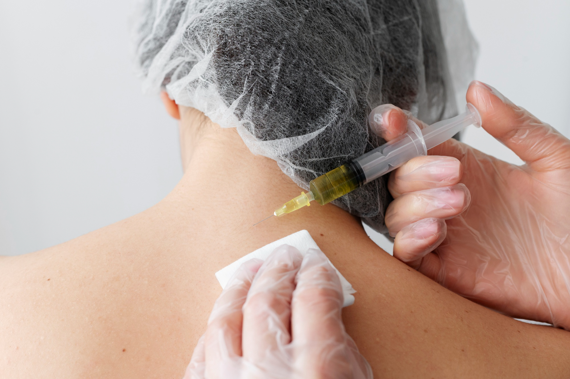 Trigger Zone Steroid Injections for Back & Neck Muscle Spasm