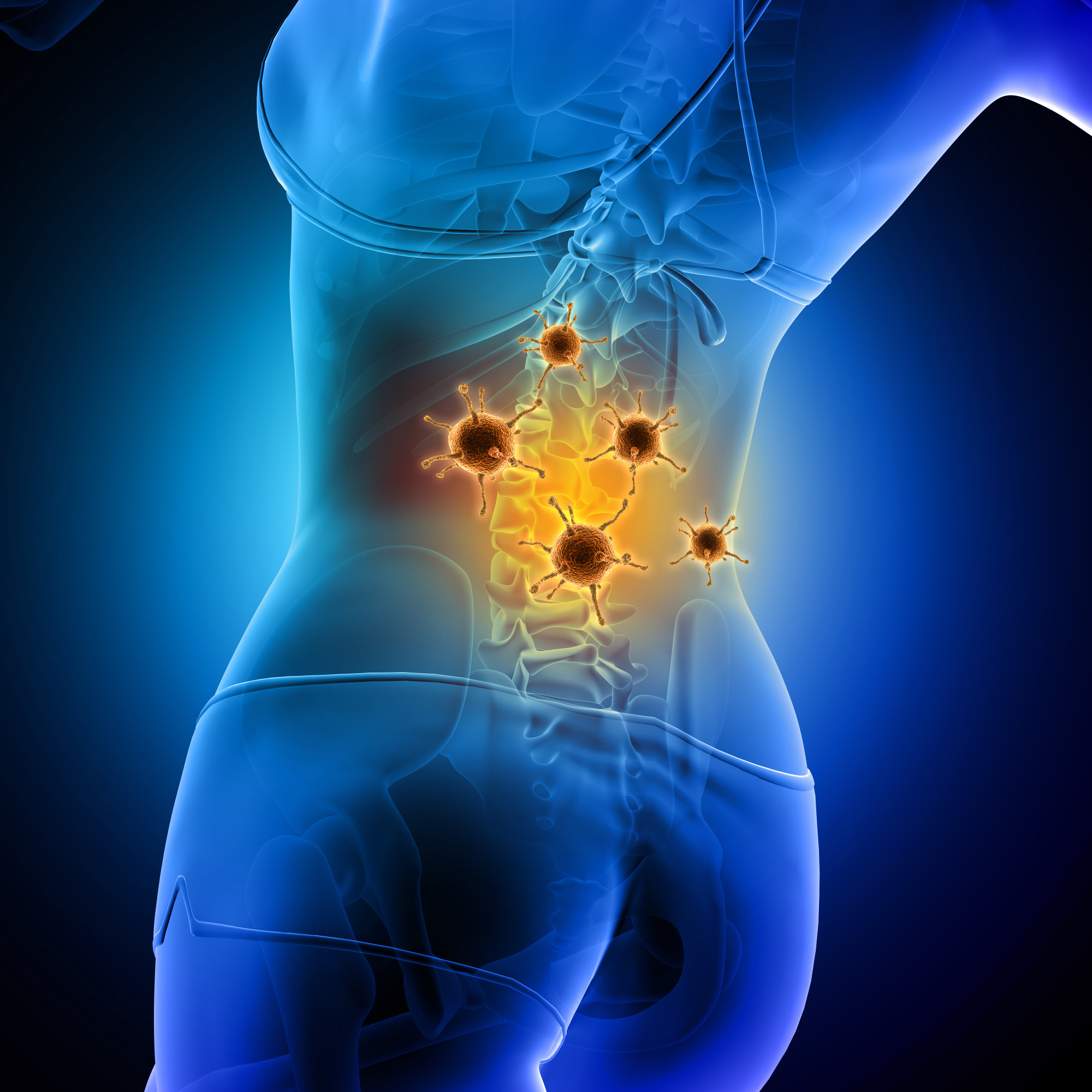 Coeliac Plexus Block