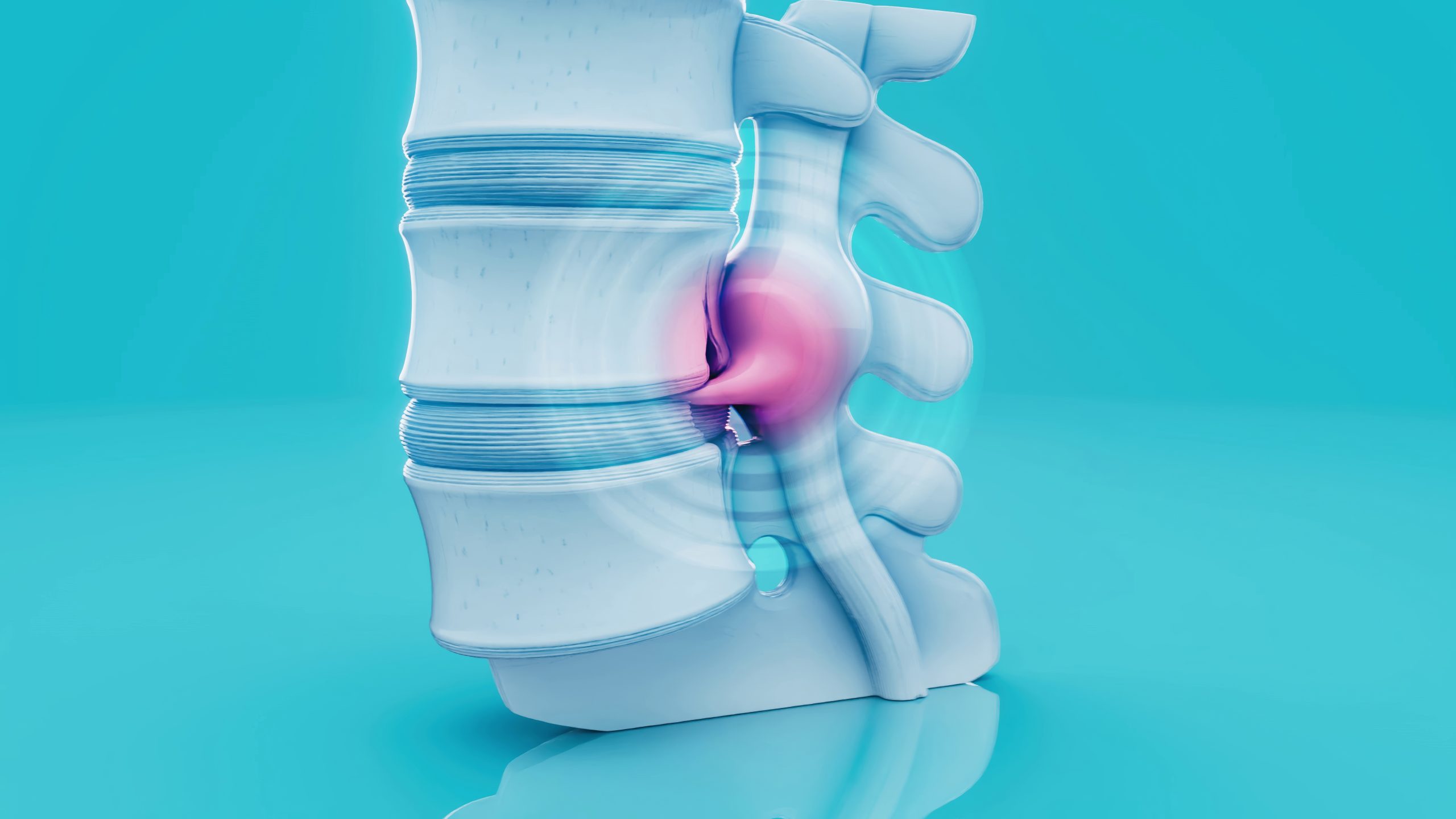 Disc degenerative disease